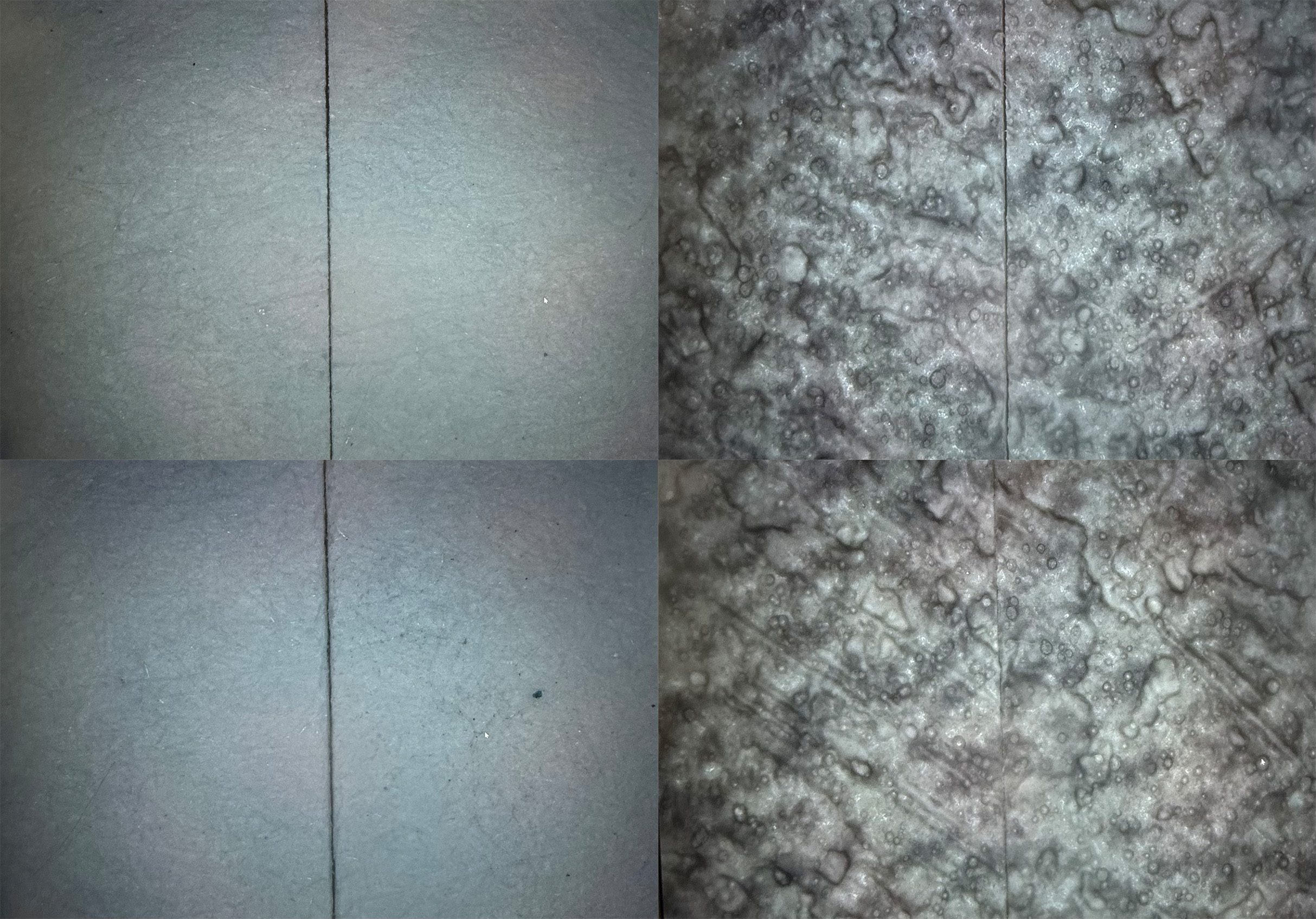 V-Schnitt vs I-Schnitt Comparison